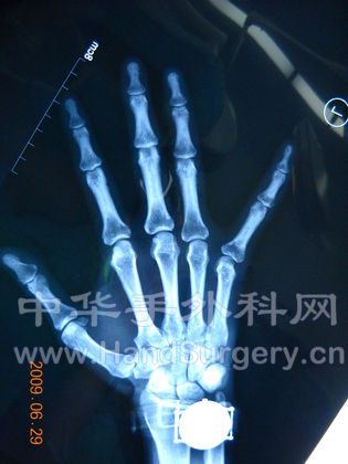 DSCN1119.JPG