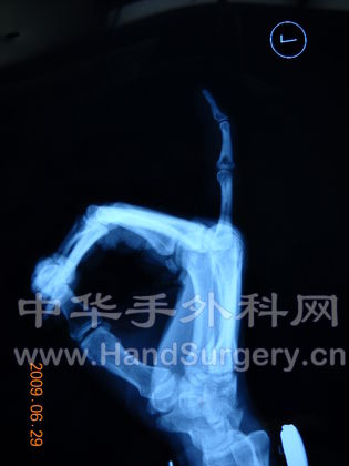 DSCN1123.JPG