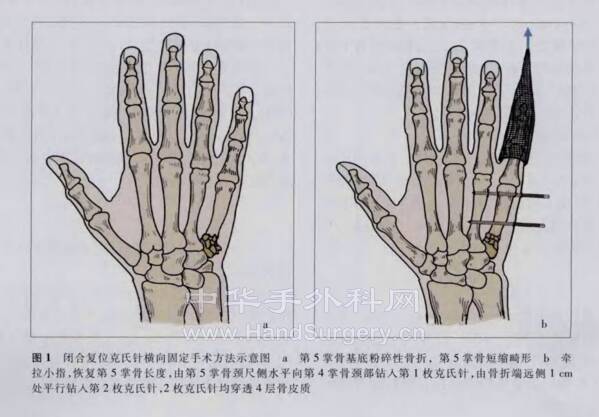 微信图片_20220614224350.png