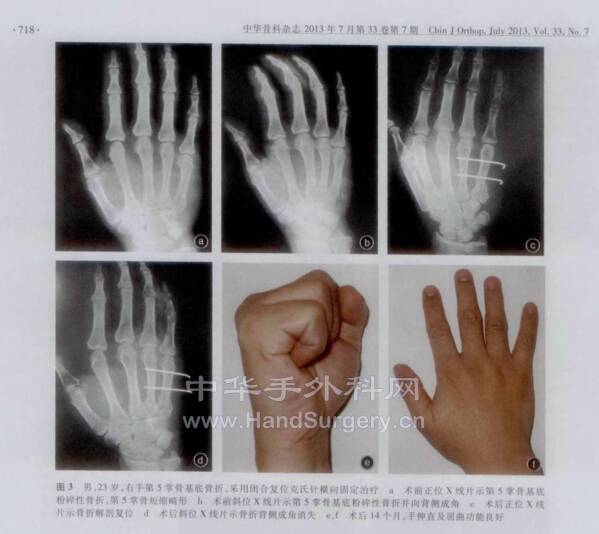 微信图片_20220614224354.png