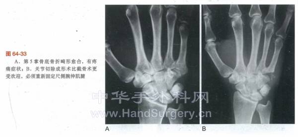微信截图_20220617223750.png