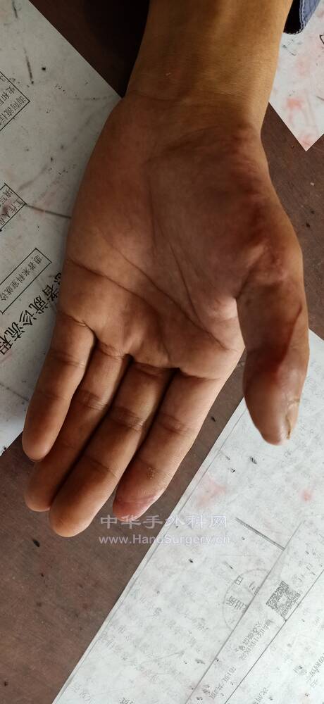 IMG20200920145100.jpg
