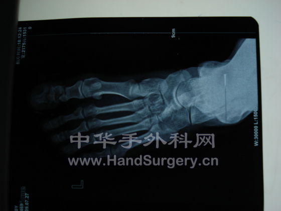 骨三科键哥作品
