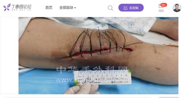 微信截图_20220717204424.png