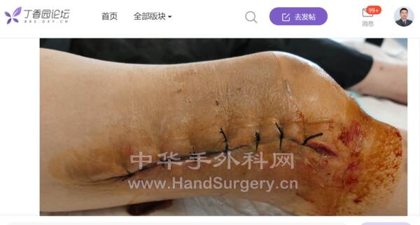 微信截图_20220717204443.png