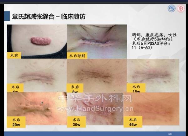 Screenshot_20220802_194242_com.tencent.mm_edit_928116559399525.jpg