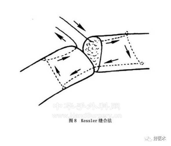 downloadfile-1661149691006.jpeg