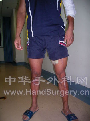 双腿能直立承重.JPG
