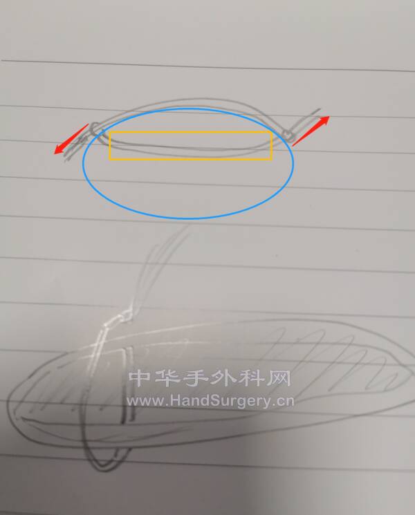44.png