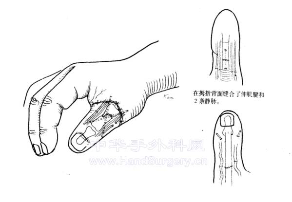 mmexport1667007625225.png