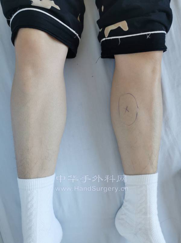 微信截图_20221224172406.png