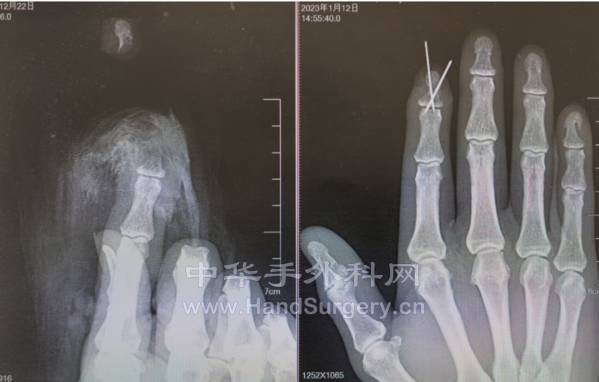 微信截图_20230115213918.png