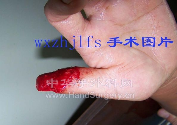 100_1287.JPG