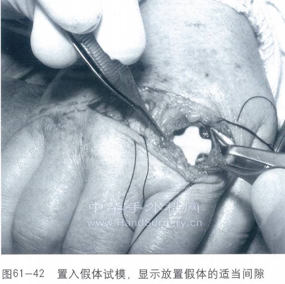 微信截图_20230210230714.png