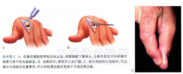 微信截图_20230210235802.png