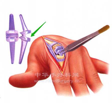 微信截图_20230211001114.png