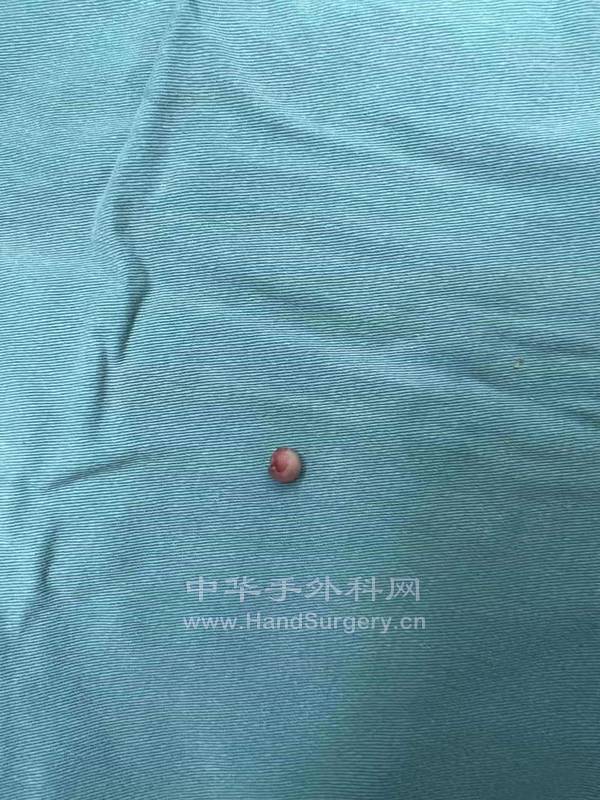 术前