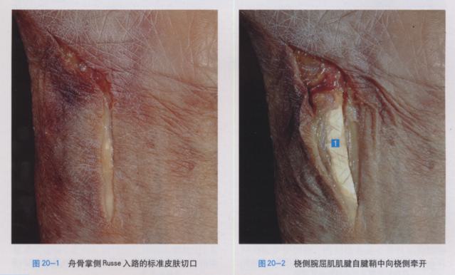 QQ截图20230622233159.png