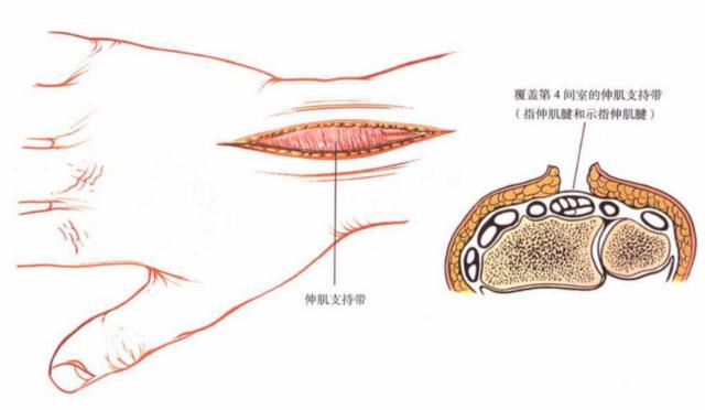 QQ截图20230623004811.png