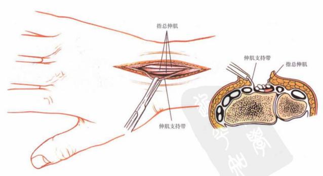 QQ截图20230623004823.png