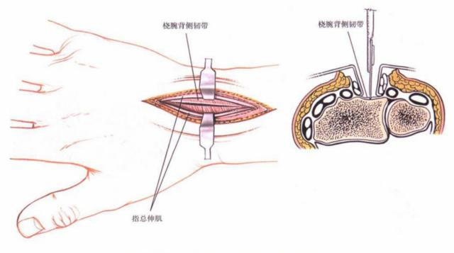 QQ截图20230623004838.png