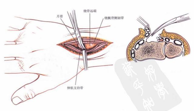 QQ截图20230623004902.png