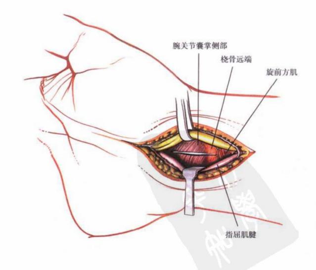 QQ截图20230623004541.png