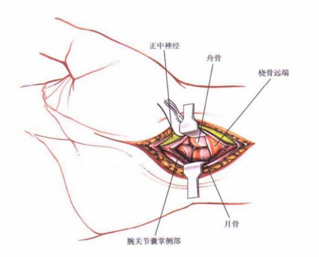 QQ截图20230623004603.png
