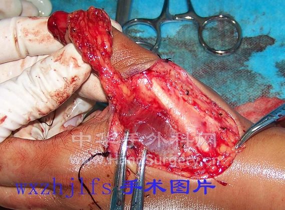 100_1300.JPG