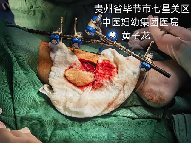 切取后