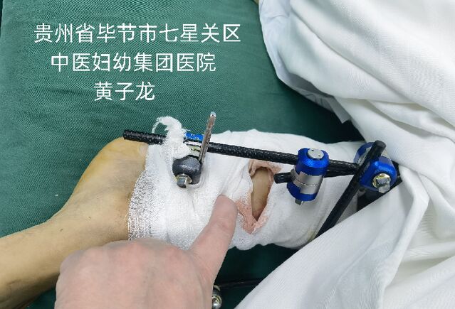 观察1h