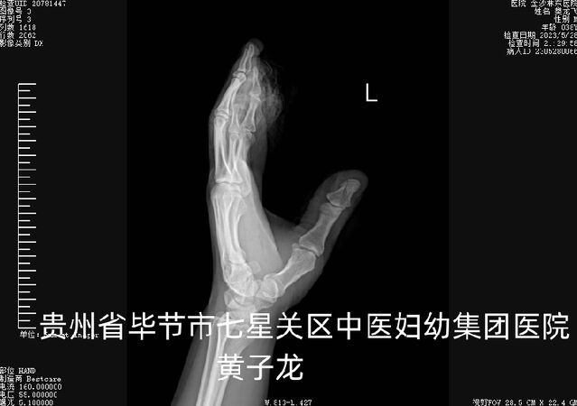 图片13.png