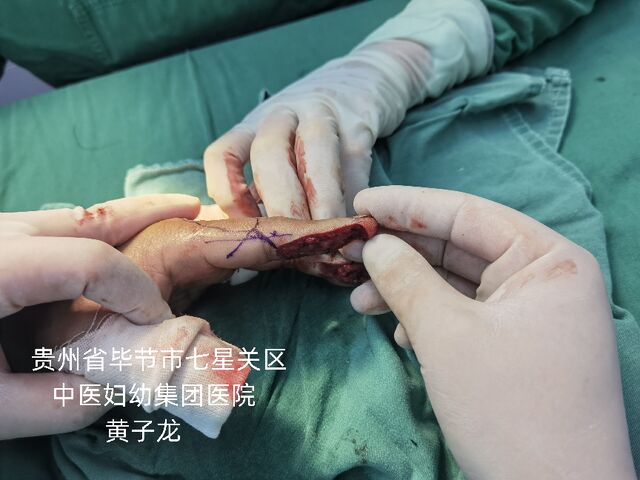 图片20.png