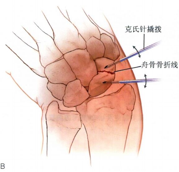 微信截图_20231108213453.png
