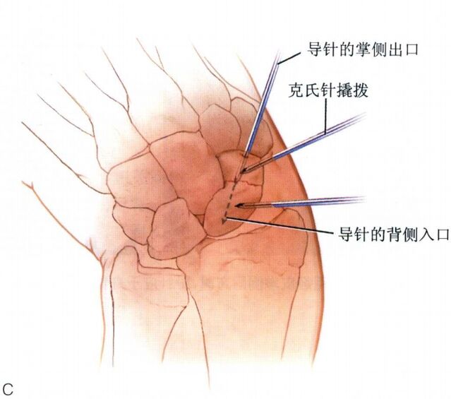 微信截图_20231108213506.png