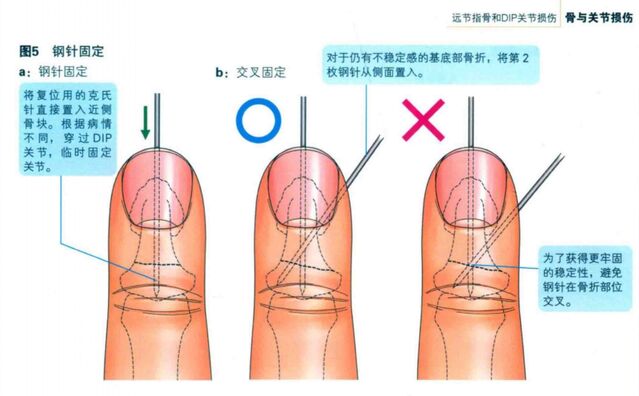 微信截图_20240119220212.png