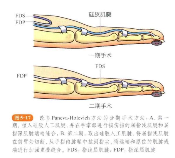 微信截图_20240422204737.png