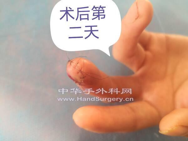 IMG_20201007_221505.jpg
