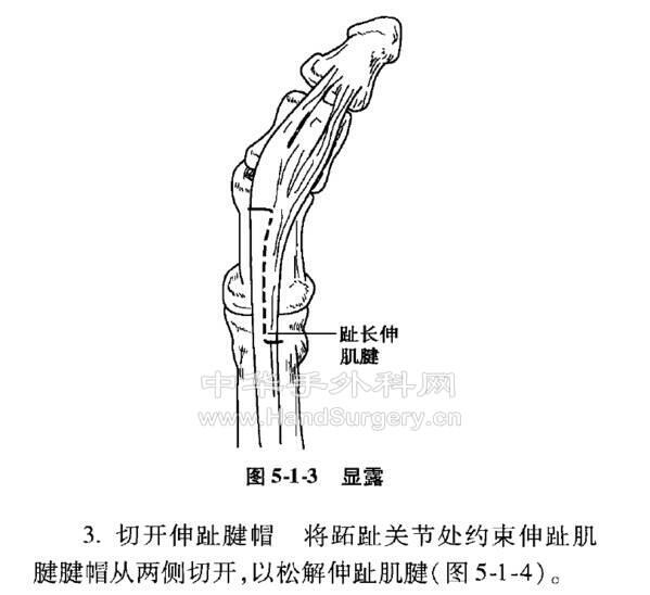 微信截图_20201109221953.png