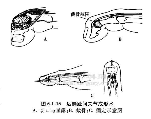 微信截图_20201109230430.png