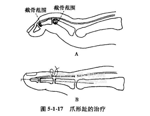 微信截图_20201109230958.png