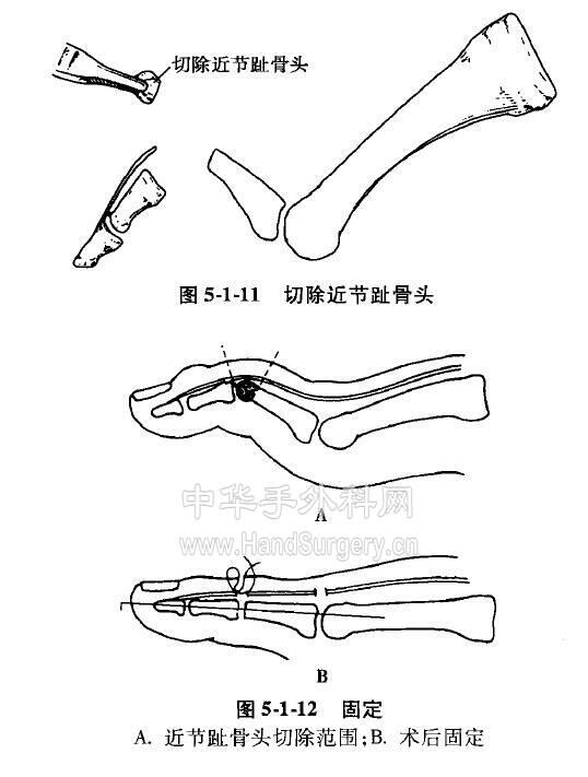 微信截图_20201109225951.png