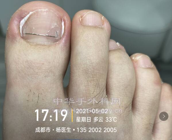 微信截图_20210504223249.png