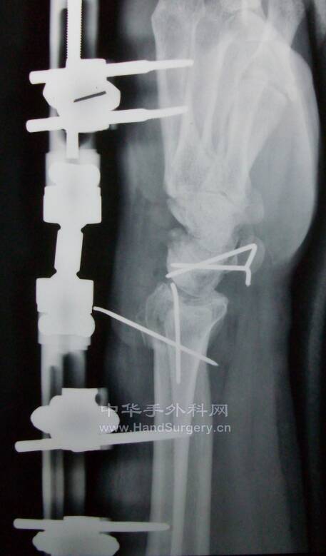 微信图片_20210506200850.png
