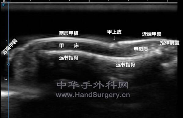 截图20211126110231.png