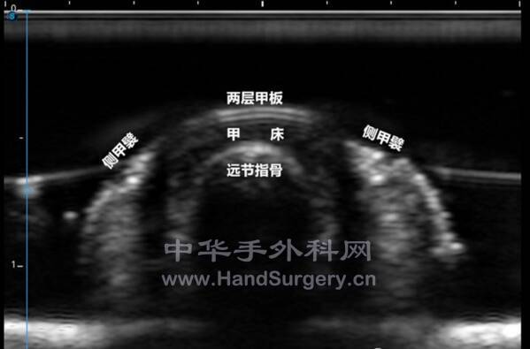 截图20211126110250.png
