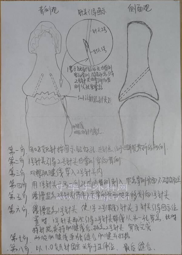 图解
