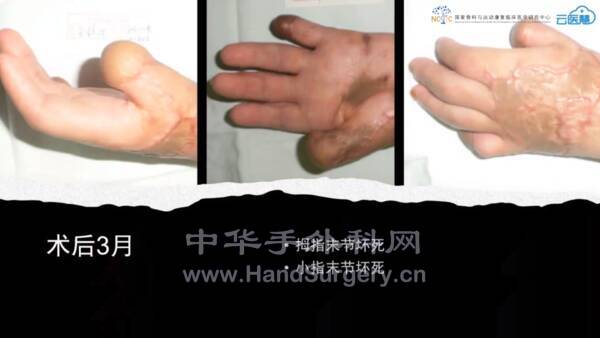 微信截图_20211129125424.png