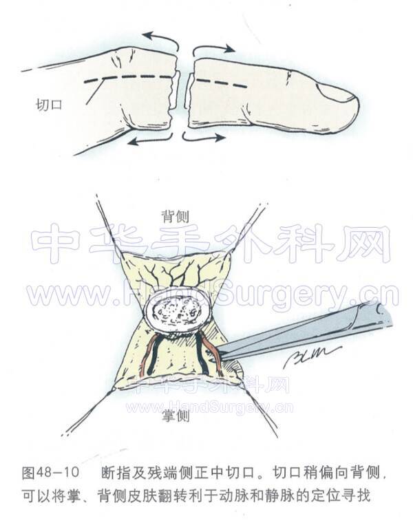 QQ鎴浘20220105201045.png