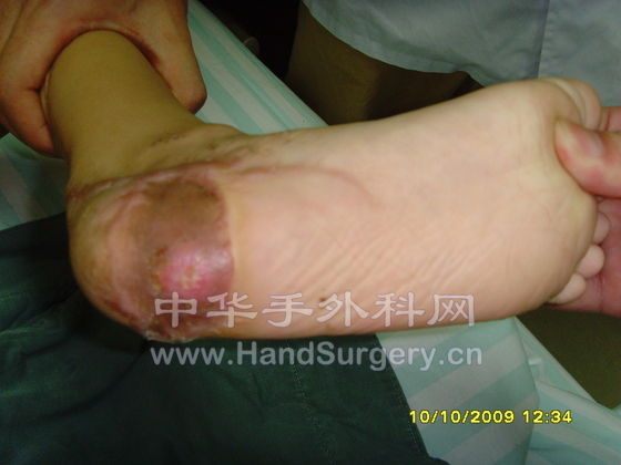 SNV32595.JPG